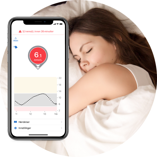 dexcom g6 kalibrering