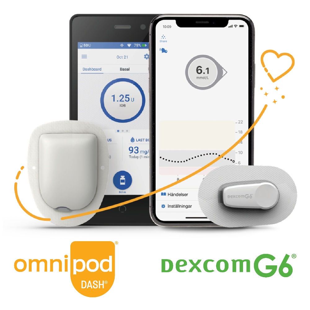 nordic infucare dexcom